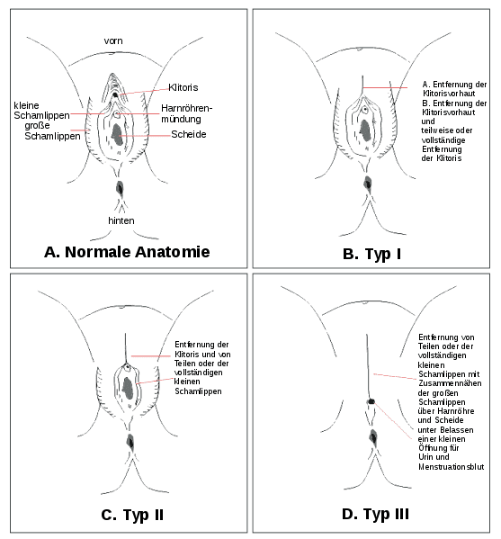 weibliche vagina bilder nach der geburt